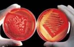 محیط Blood Agar تصویر دوم