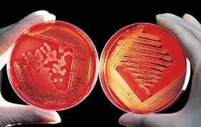 محیط Blood Agar تصویر دوم