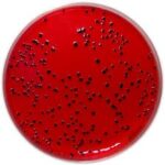 محیط کشت Blood Agar و همولیز