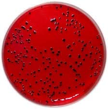 محیط کشت Blood Agar و همولیز