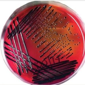 محیط کشت Blood Agar و همولیز تصویر دوم